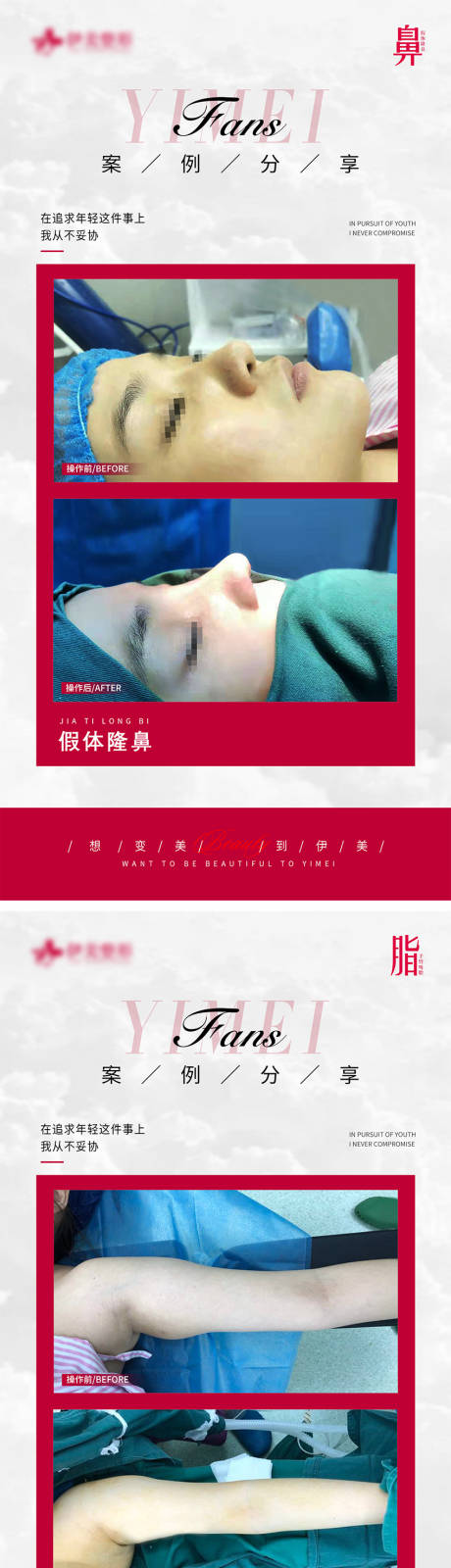 源文件下载【享设计】搜索编号：46930021655544569【医美案例对比】