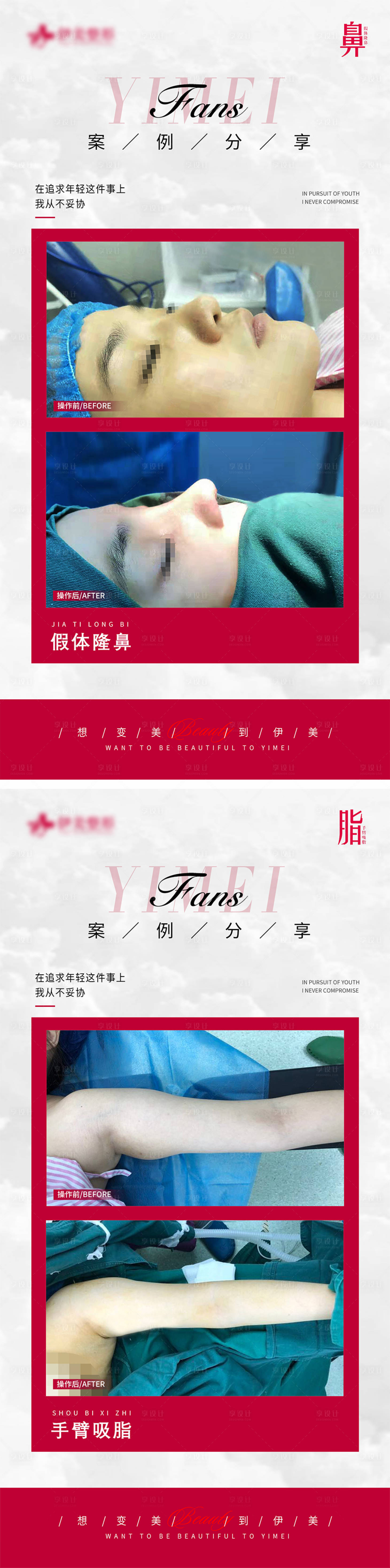 源文件下载【享设计】搜索编号：46930021655544569【医美案例对比】