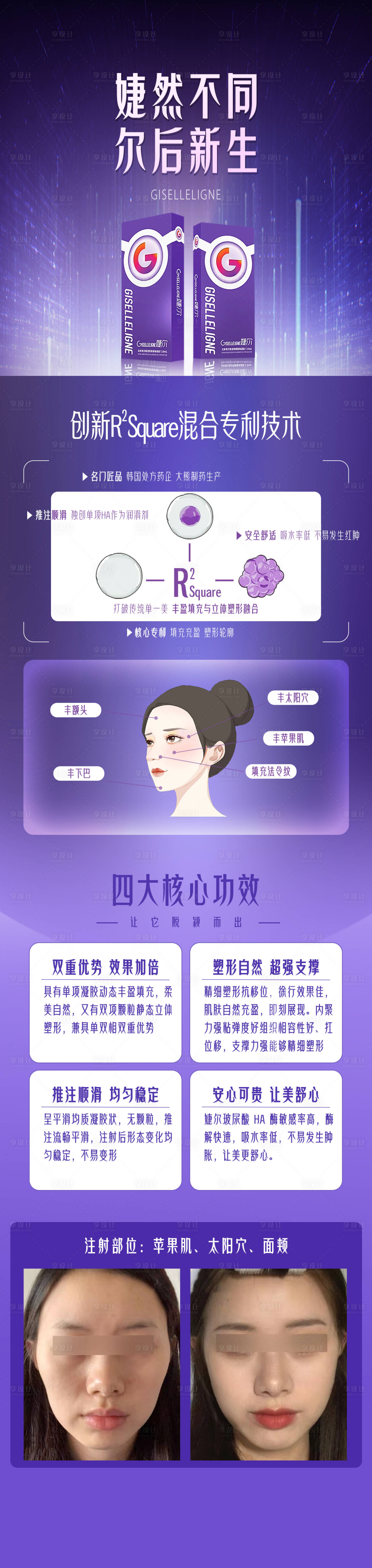 源文件下载【捷尔玻尿酸】编号：20240111093901575