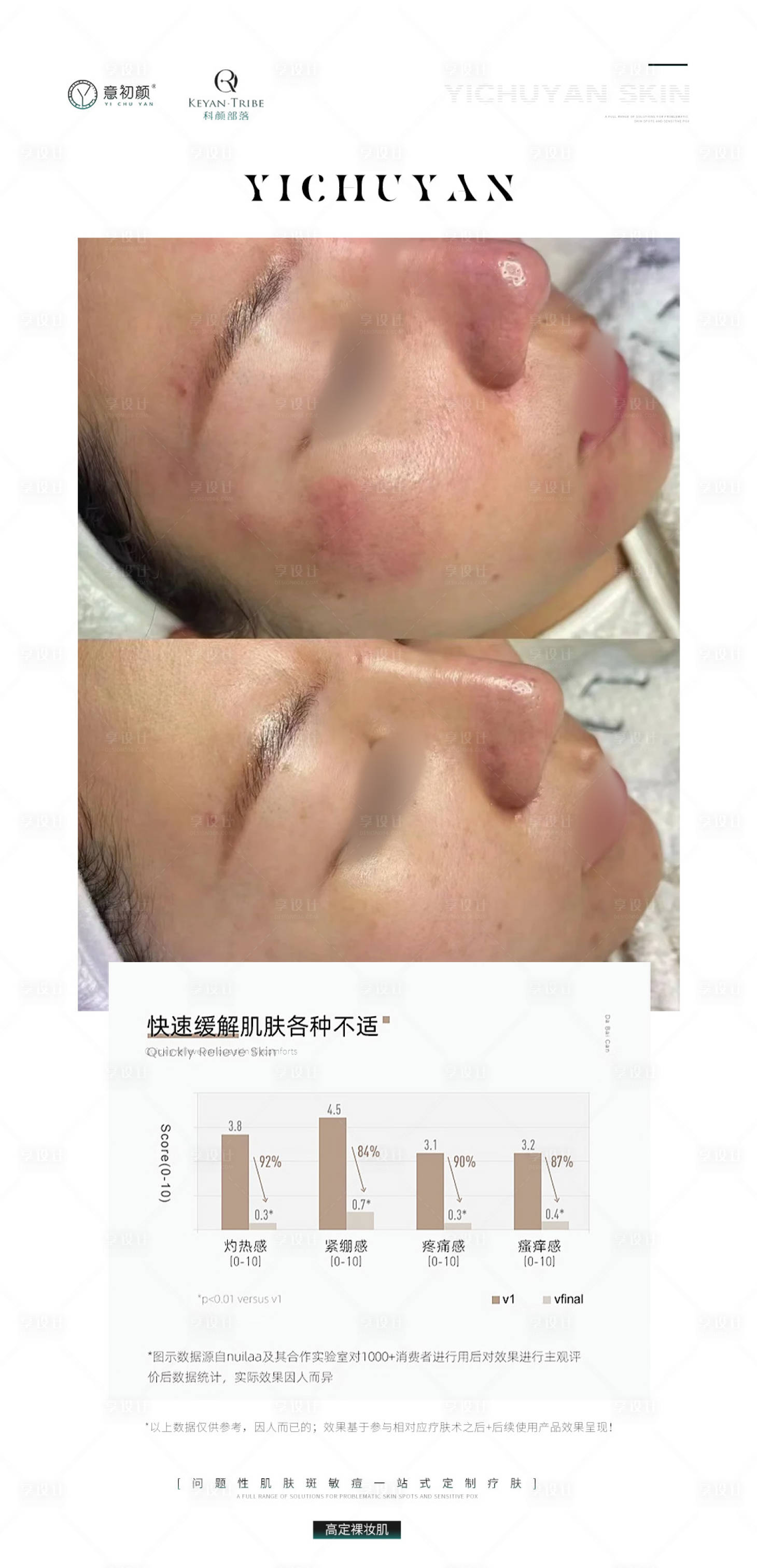 源文件下載【享設計】搜索編號：49340021350215283【醫美美容祛斑美白痘痘模特海報】