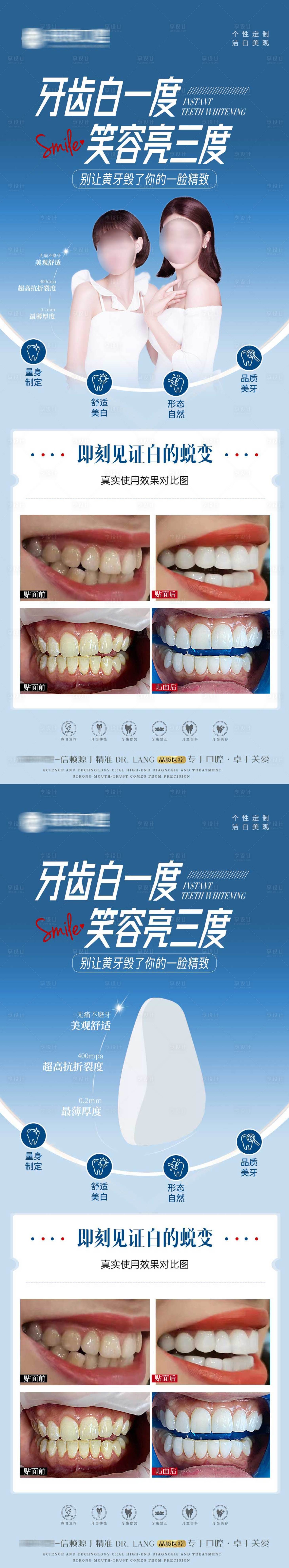 源文件下载【口腔牙贴面案例海报】编号：14070021365142845
