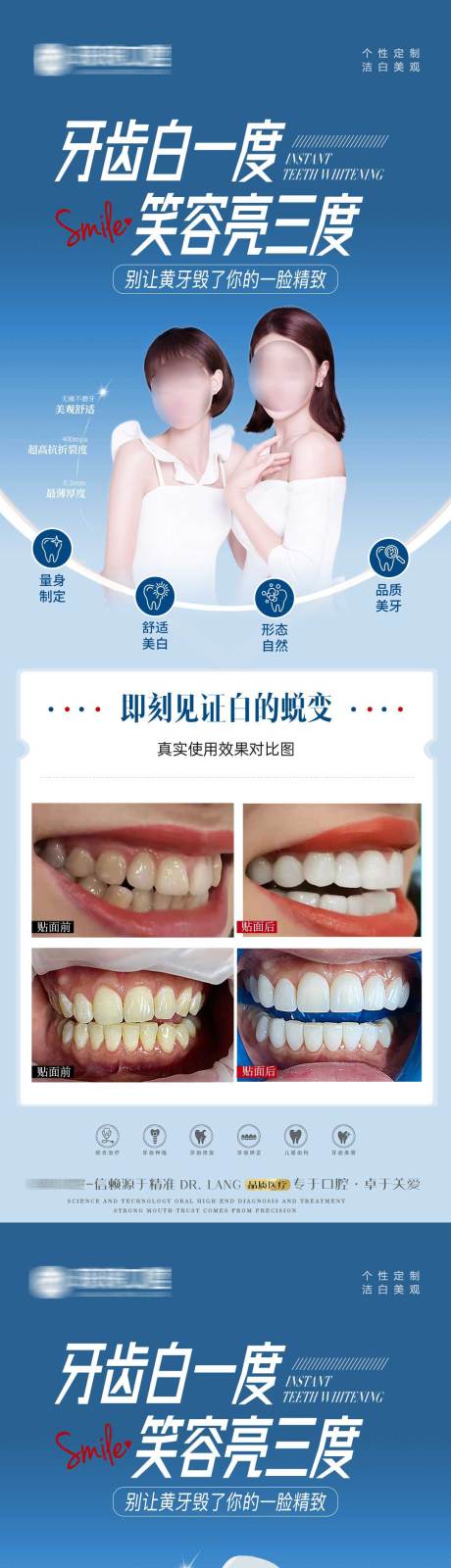 口腔牙贴面案例海报-源文件【享设计】