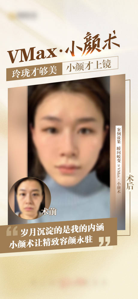 源文件下载【享设计】搜索编号：95420021299085183【医美 】