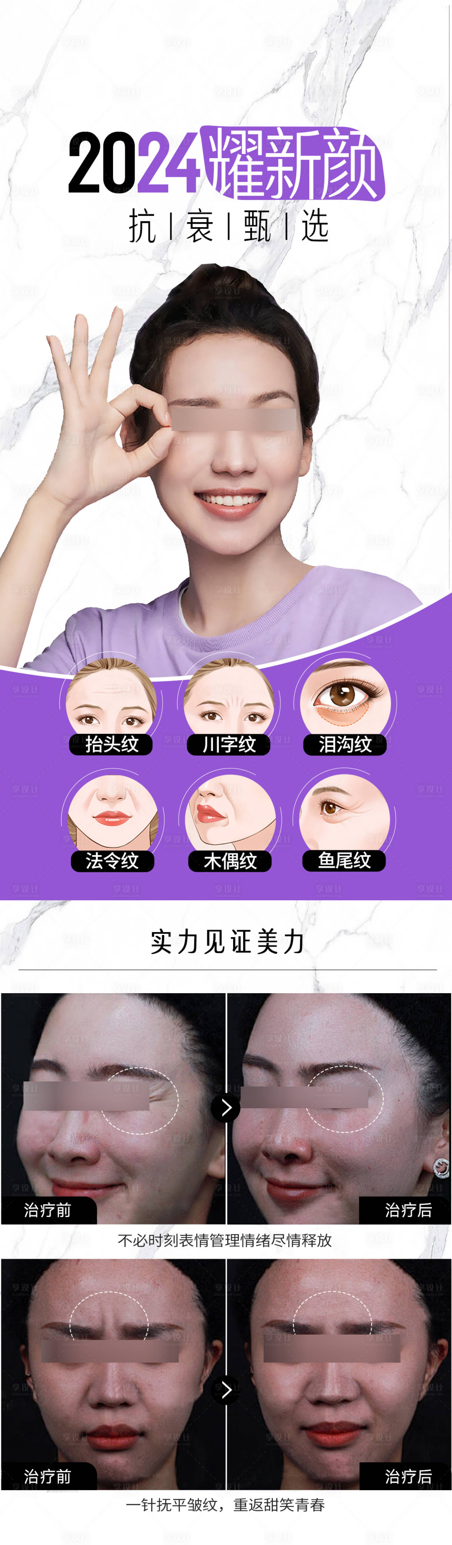 源文件下載【享設(shè)計】搜索編號：97600021380631200【醫(yī)美除皺海報】