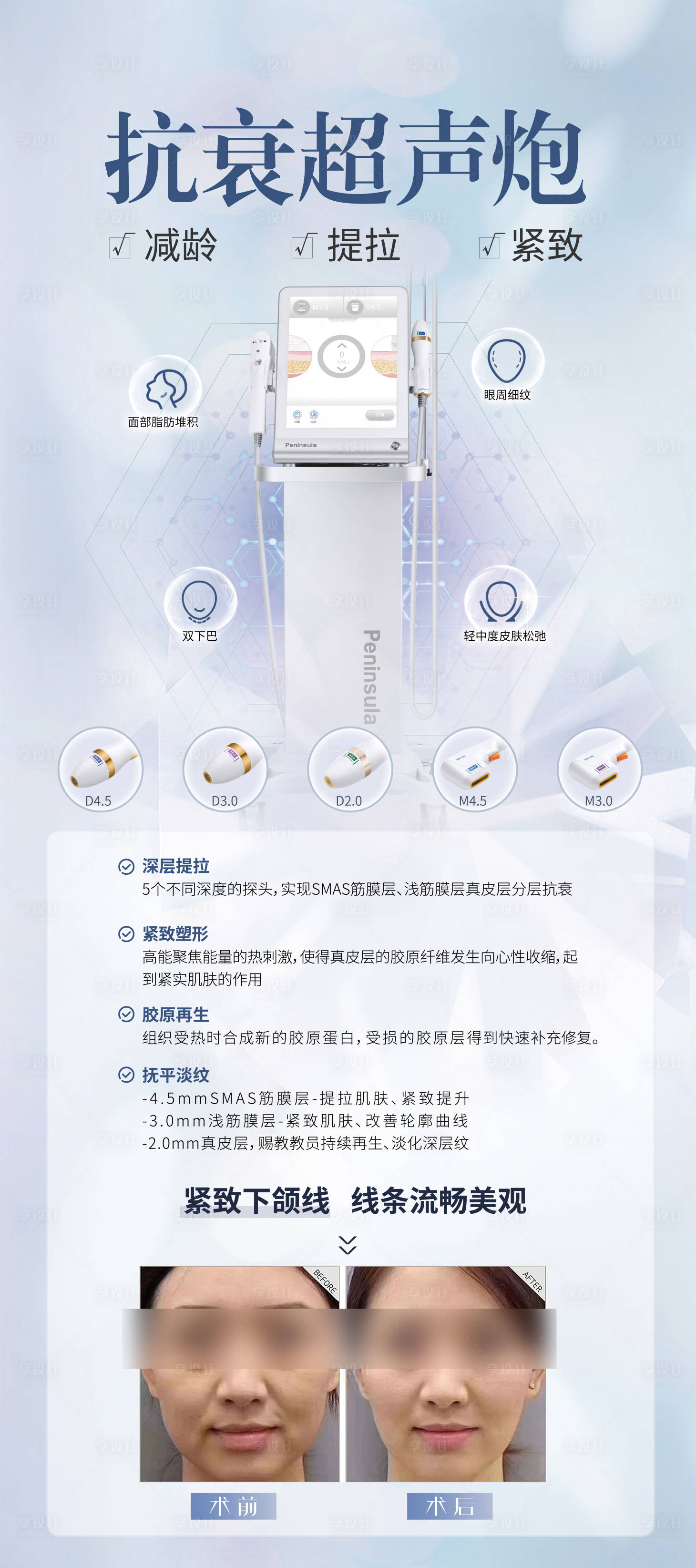 源文件下载【享设计】搜索编号：75390021375416751【超声炮抗衰海报】