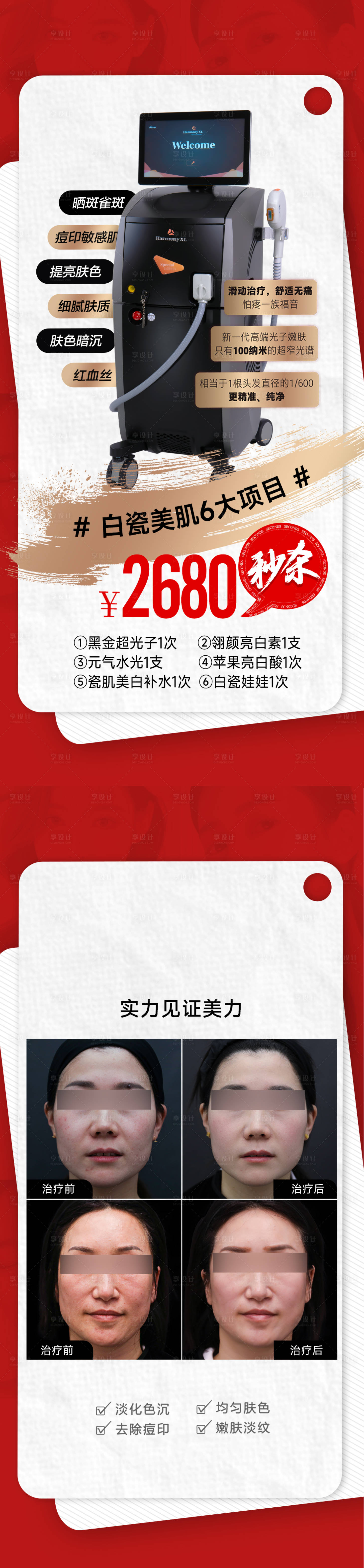 源文件下载【享设计】搜索编号：51670021365982552【医美白瓷娃娃套餐案例系列海报】