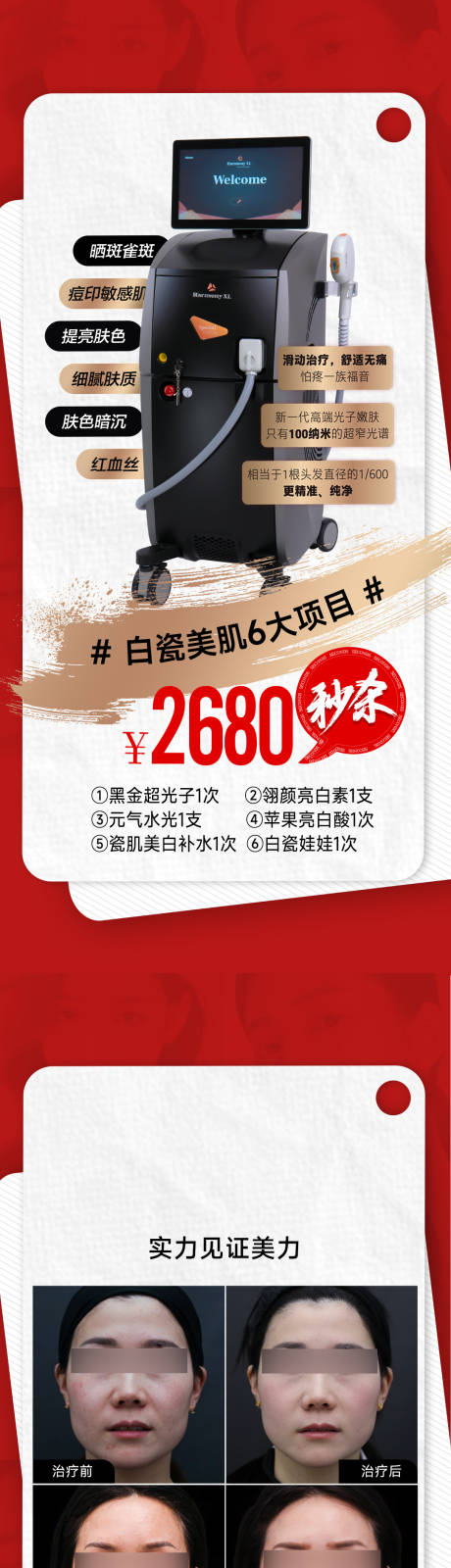 医美白瓷娃娃套餐案例系列海报