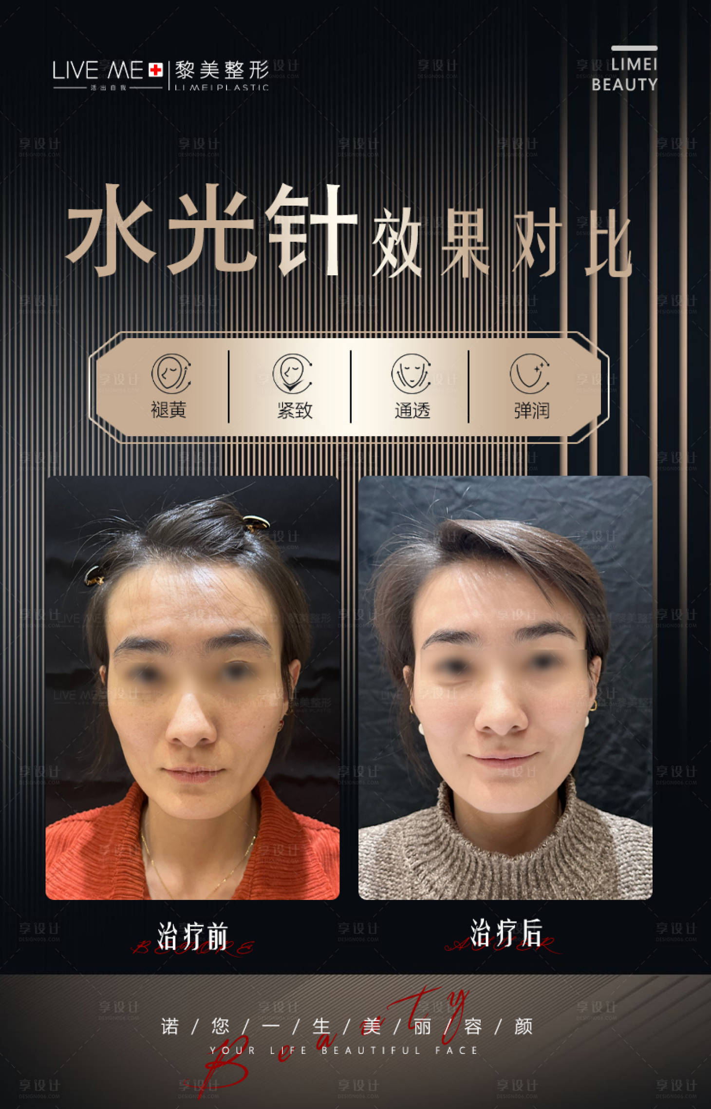 源文件下載【享設計】搜索編號：34350021537387688【水光針案例對比海報】