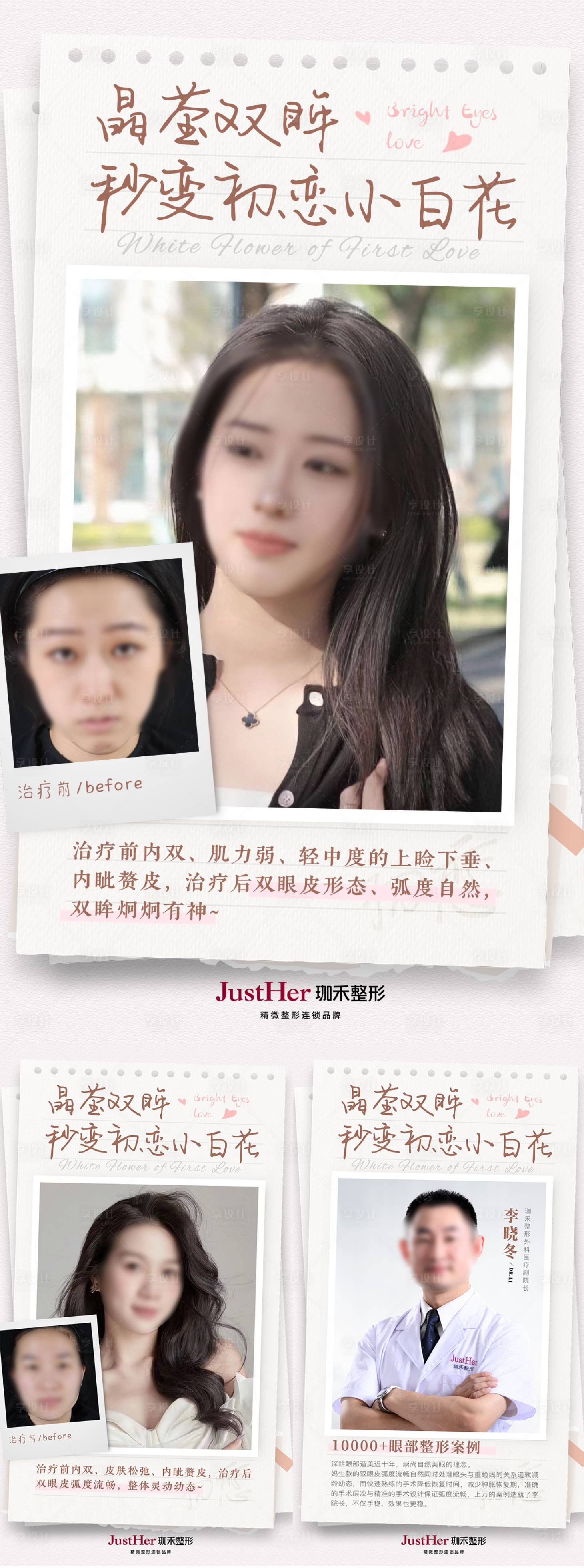源文件下载【双眼皮案例对比海报】编号：73900021662512327