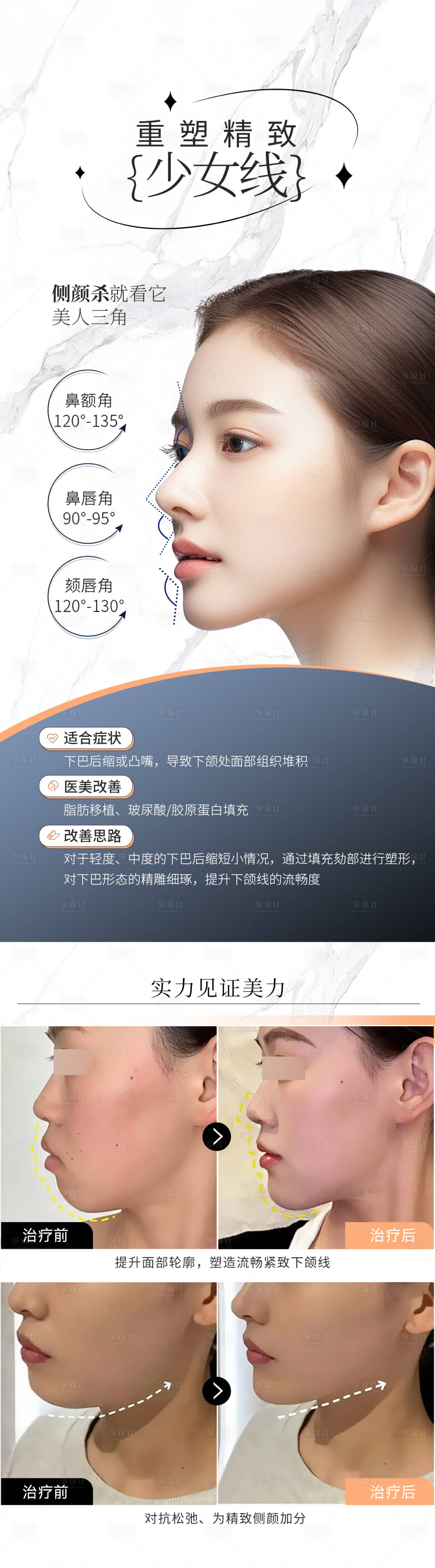 源文件下載【享設(shè)計(jì)】搜索編號：69820021617794518【醫(yī)美下頜線宣傳海報(bào)】