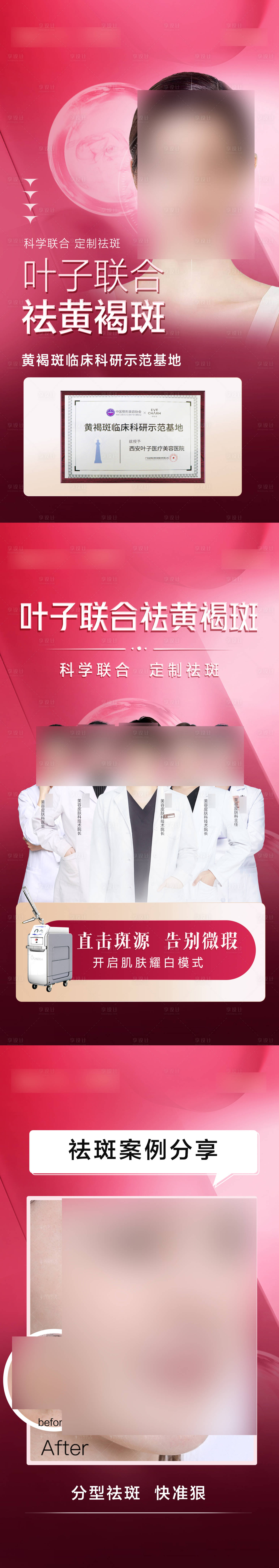 源文件下载【享设计】搜索编号：88600021609375577【医美 祛斑海报】