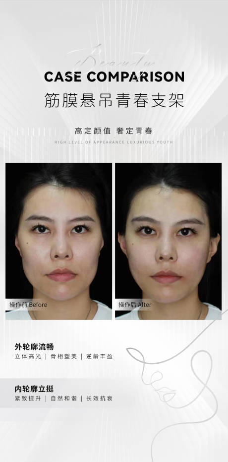 源文件下载【享设计】搜索编号：62660021531485615【医美简约案例对比海报】