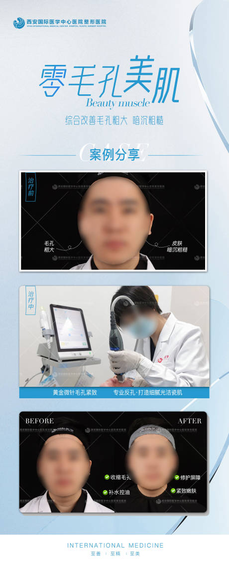 源文件下载【医美整形皮肤黄金微针海报 】编号：75640021322738871