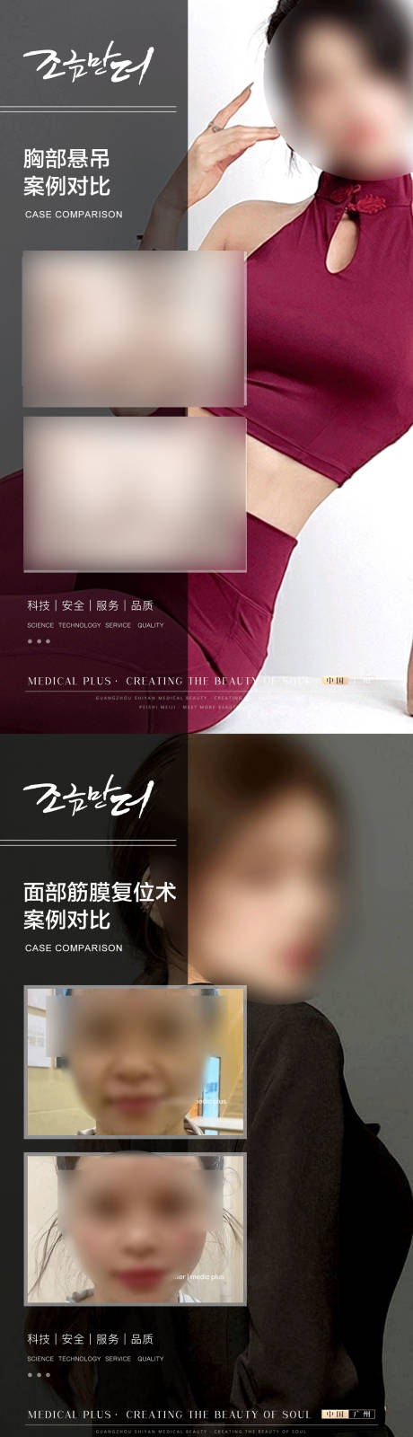 源文件下載【整形真人案例分享集】編號：46270017242979502