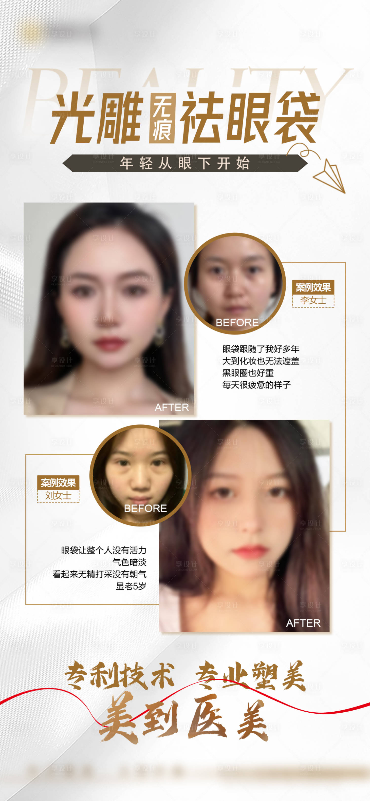 源文件下载【享设计】搜索编号：13430021764978992【眼袋医美对比图抗衰】