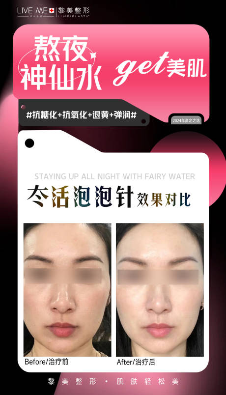 源文件下载【水光针案例海报】编号：54590021727544380