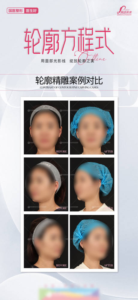 医美轮廓方程式轮廓精案例对比简约质感