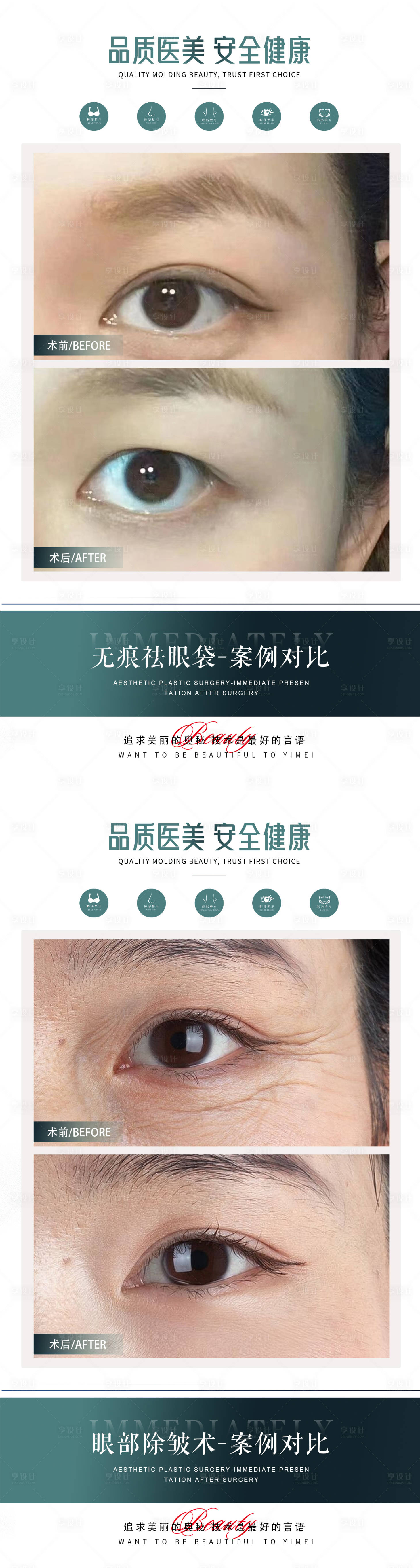 源文件下载【医美眼部案例系列海报】编号：76380021437539018