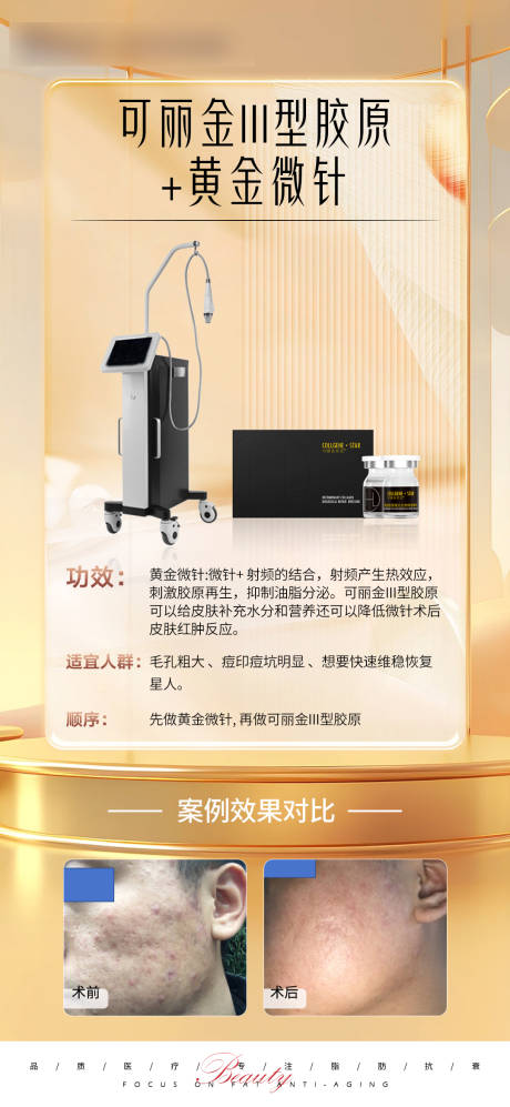 源文件下載【享設計】搜索編號：82300021655166459【黃金微針可麗金簡約海報】