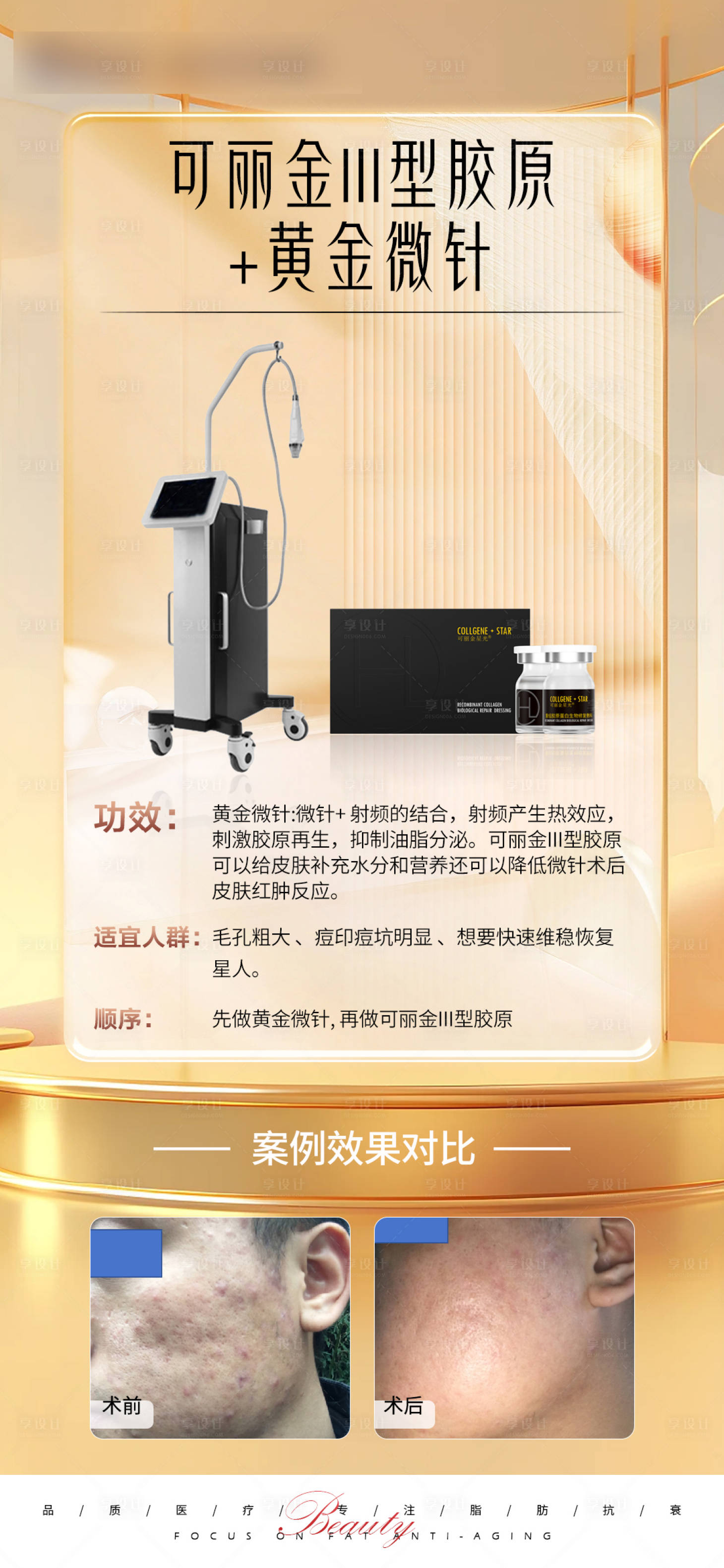 源文件下载【享设计】搜索编号：82300021655166459【黄金微针可丽金简约海报】