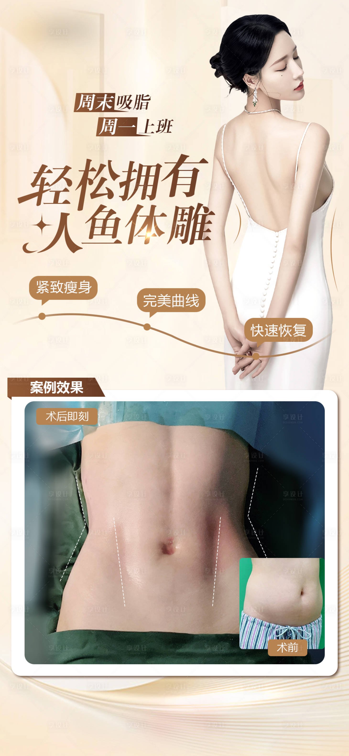源文件下载【享设计】搜索编号：42310021786388607【医美海报 （TIF用PS打开）】