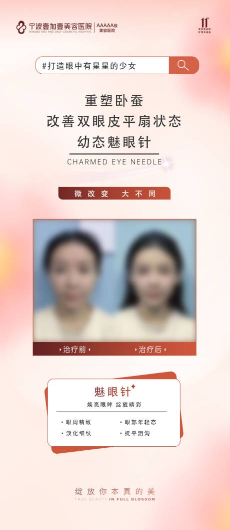 源文件下载【医美案例对比海报】编号：74950021790232648