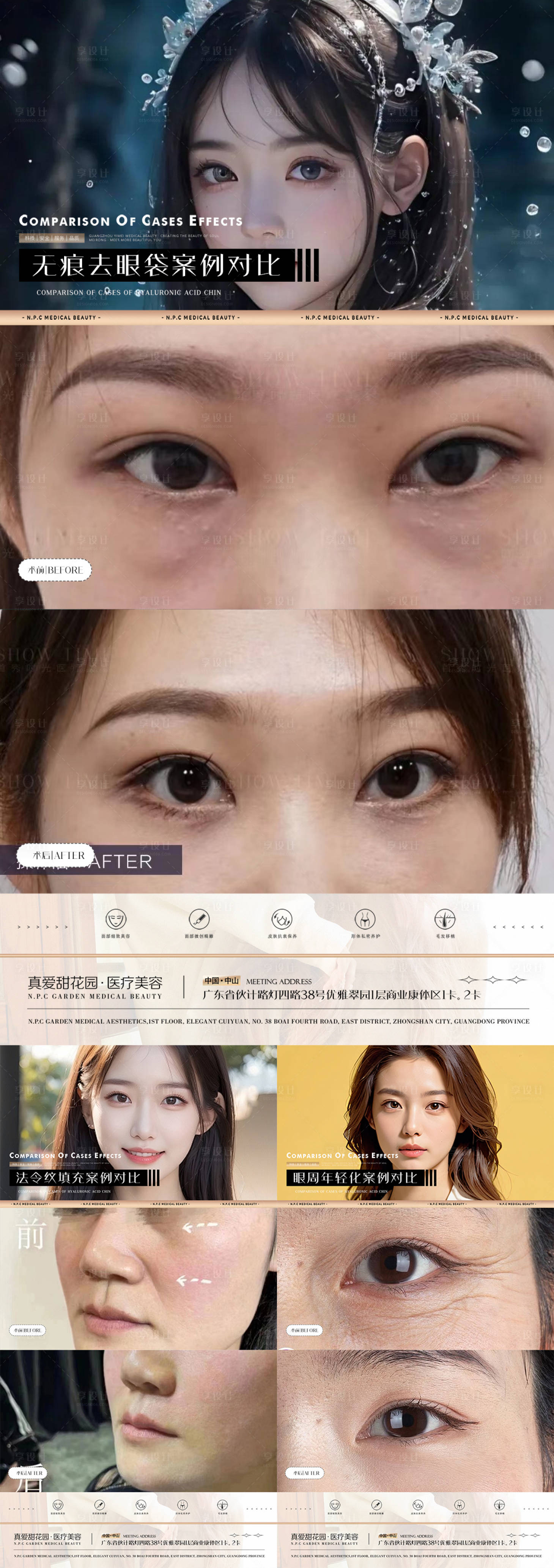 源文件下载【享设计】搜索编号：87450021651347523【医美美容案例对比系列海报】