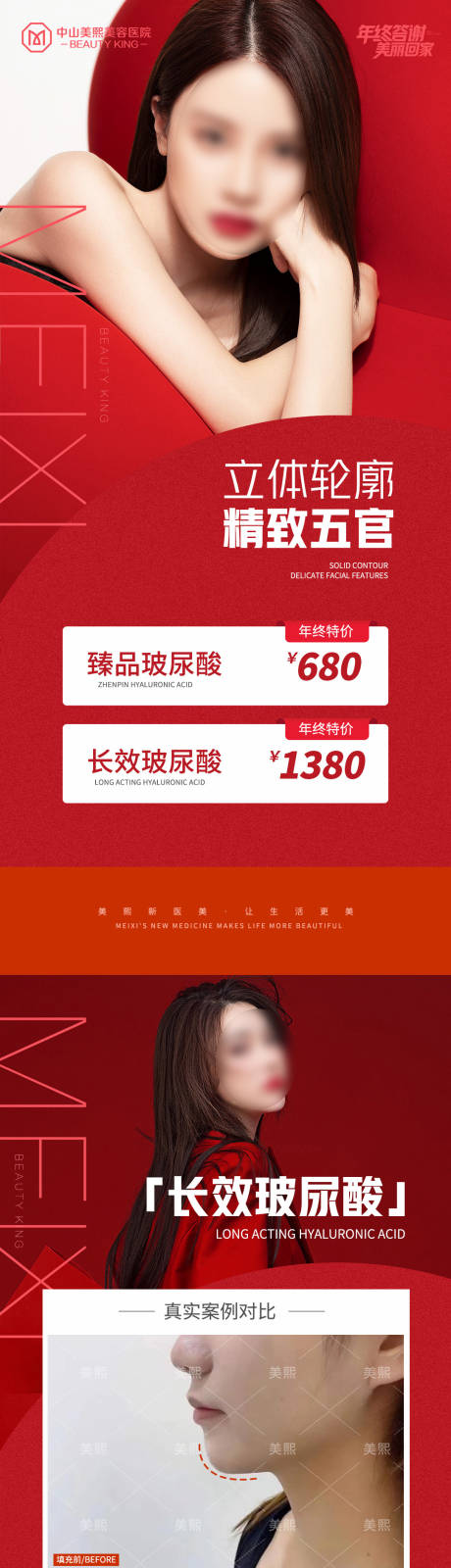 源文件下载【玻尿酸品项价格案例系列海报】编号：63090021680496077