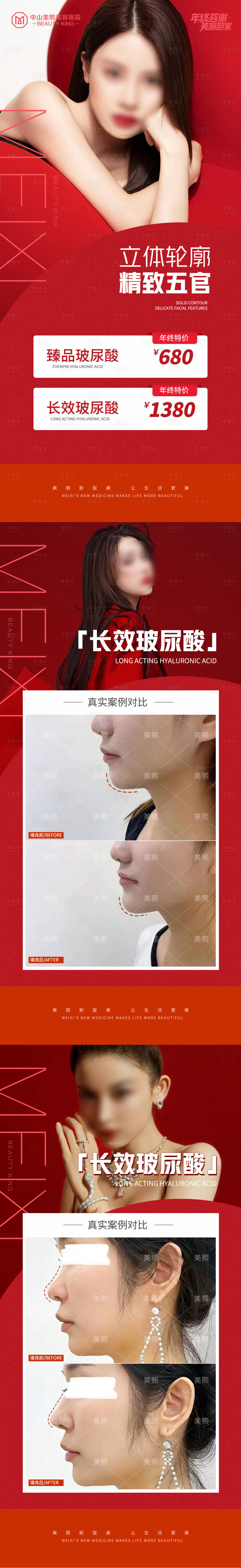 源文件下載【享設計】搜索編號：63090021680496077【玻尿酸品項價格案例系列海報】