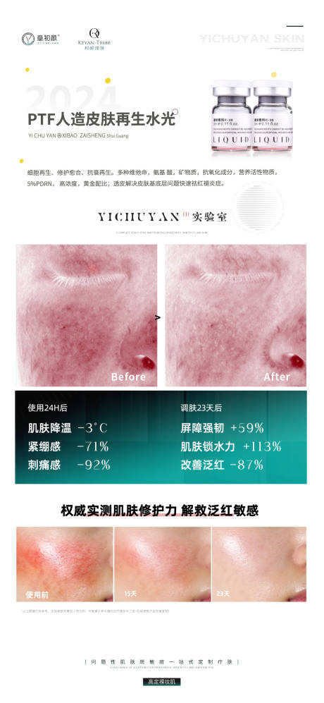 源文件下载【医美美容祛斑美白痘痘模特简约海报】编号：59970021508304517