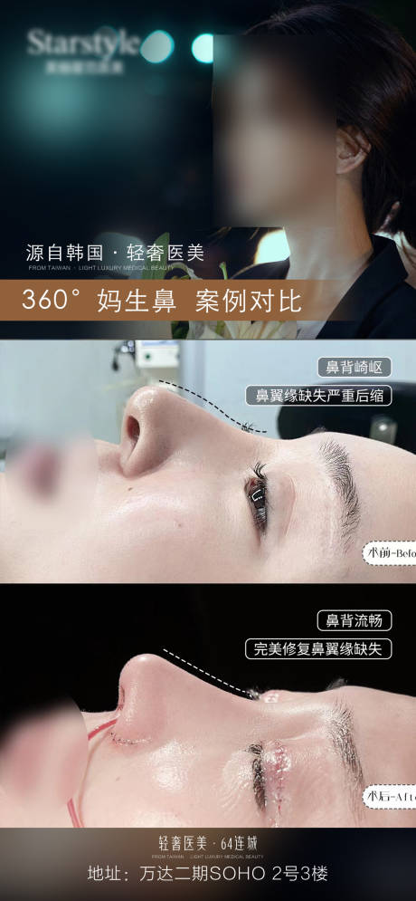 源文件下载【享设计】搜索编号：13780021273265283【医美隆鼻案例海报】