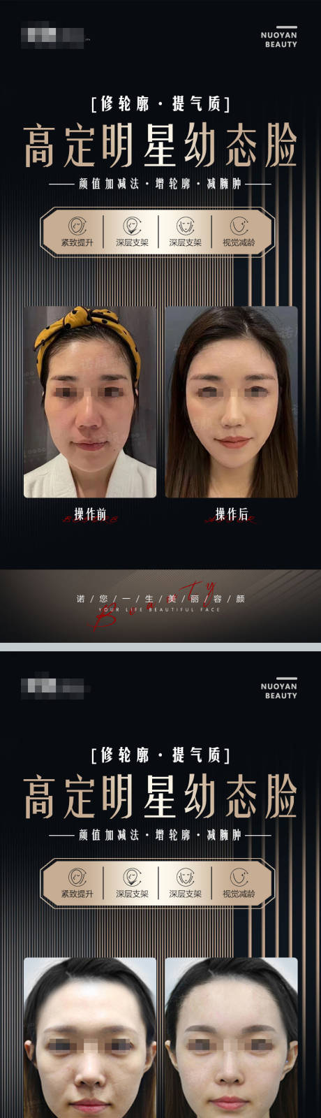 源文件下载【享设计】搜索编号：31140021504726050【幼态脸案例海报】