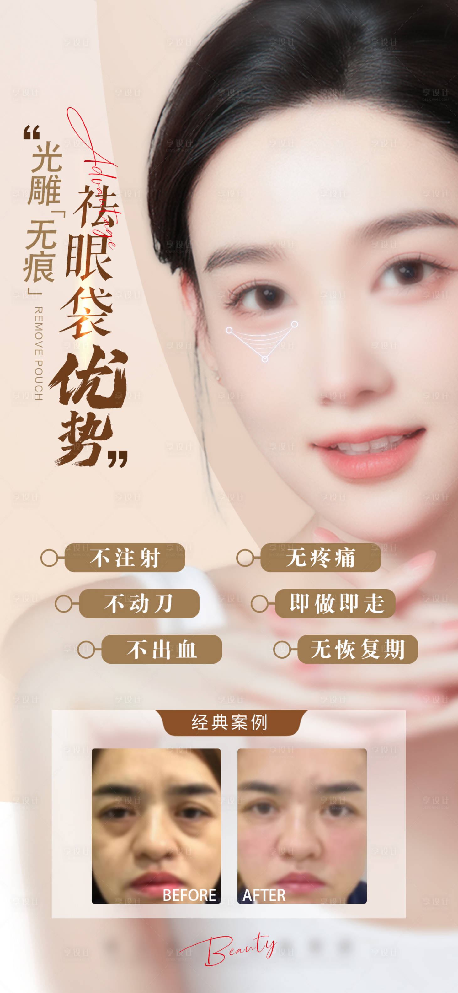 源文件下载【享设计】搜索编号：53660021619806097【医美祛眼袋海报】