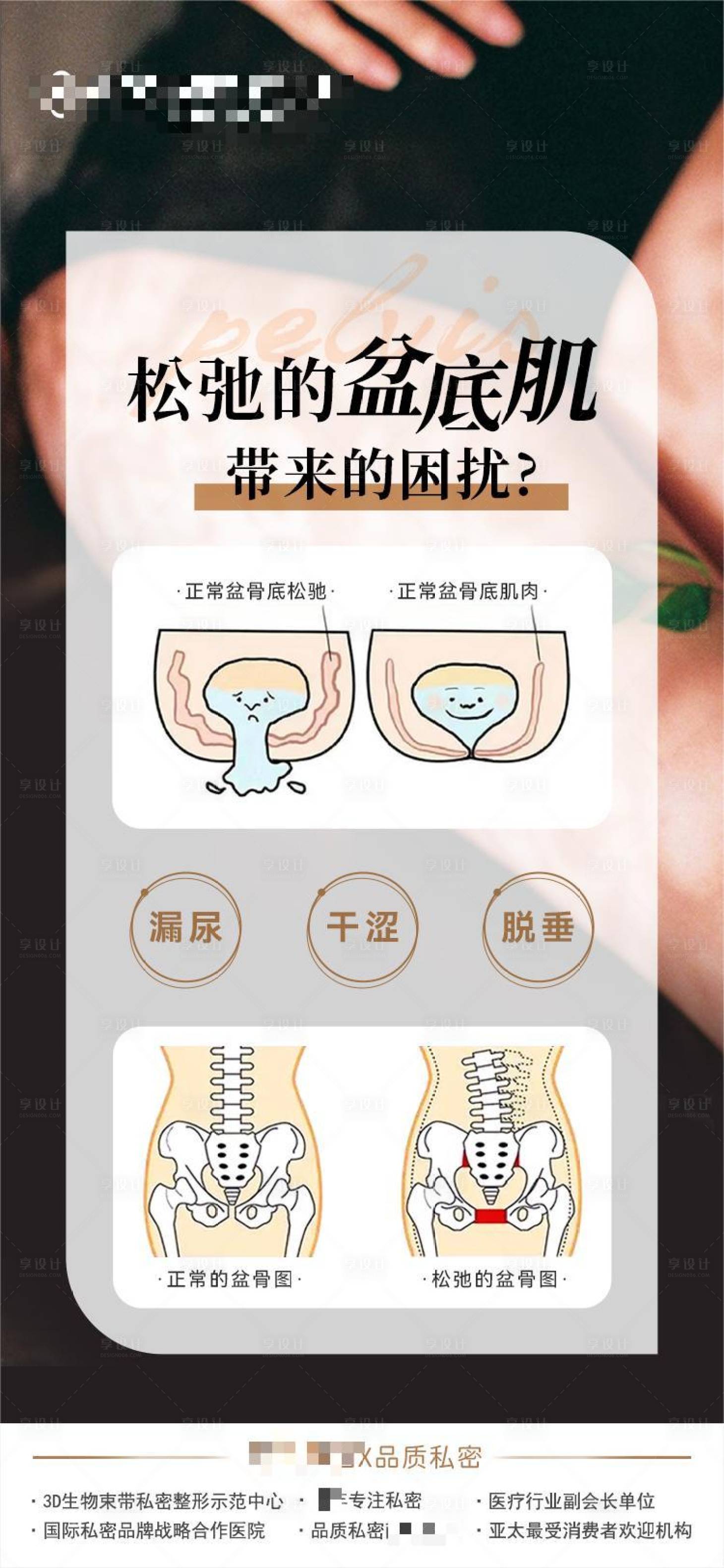 源文件下載【享設計】搜索編號：96850021619406608【松弛盆底肌帶來的困擾海報】