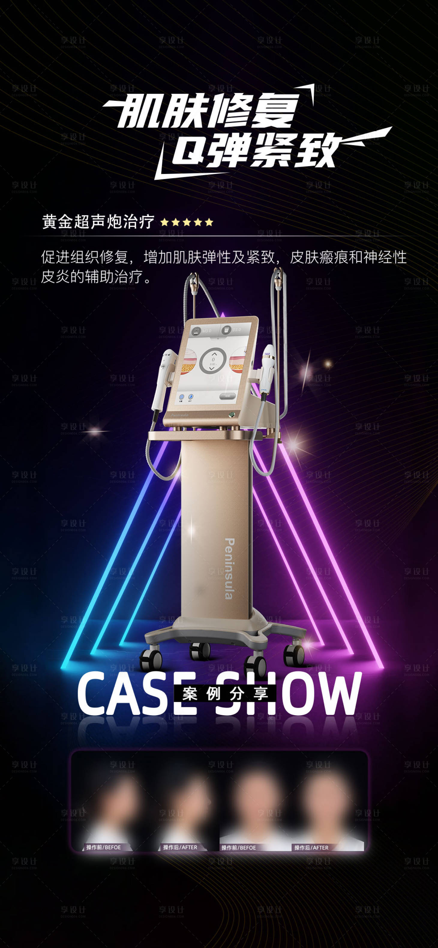 源文件下载【黄金超声炮海报】编号：43250021683501014