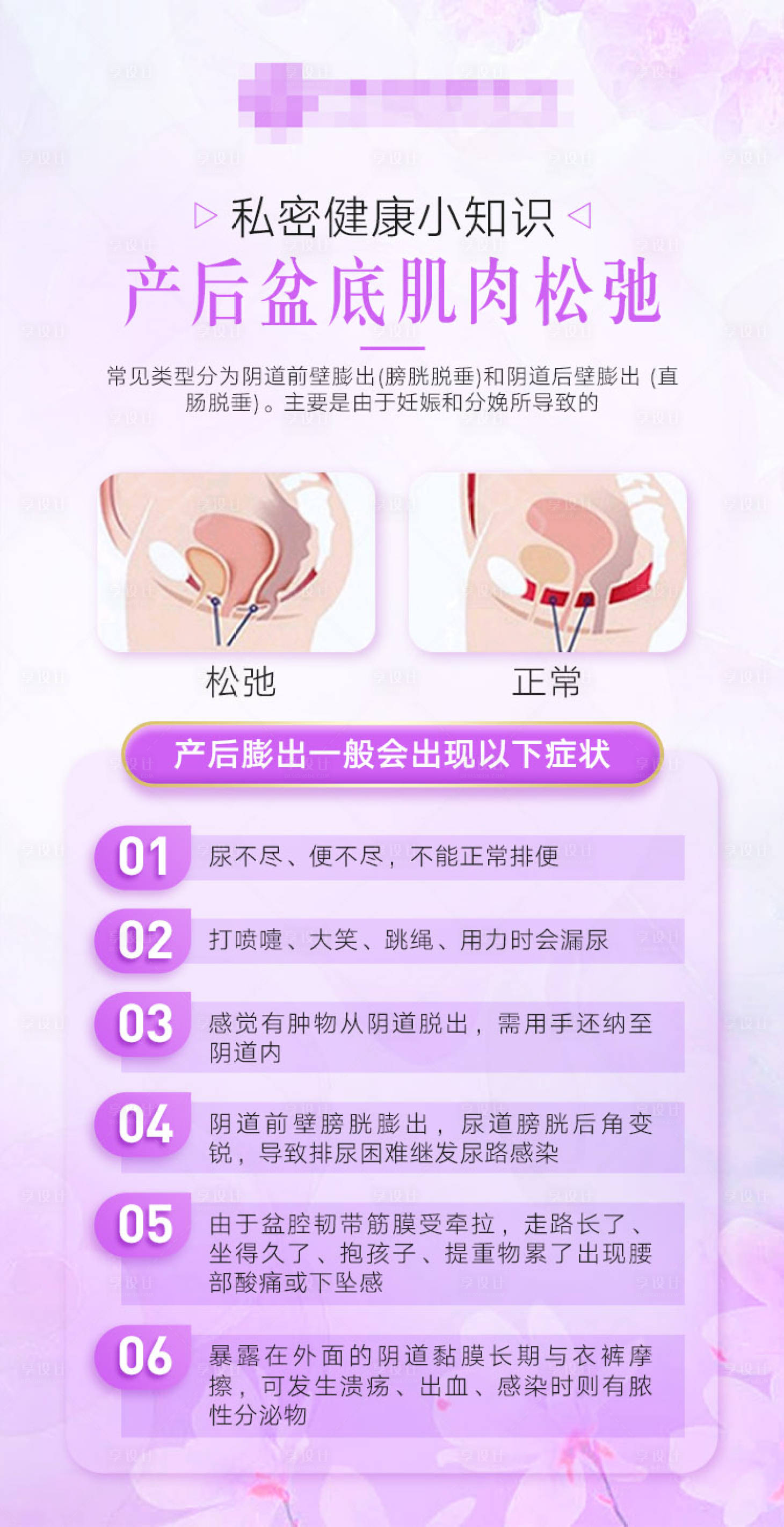 源文件下载【私密海报】编号：67060021426441724