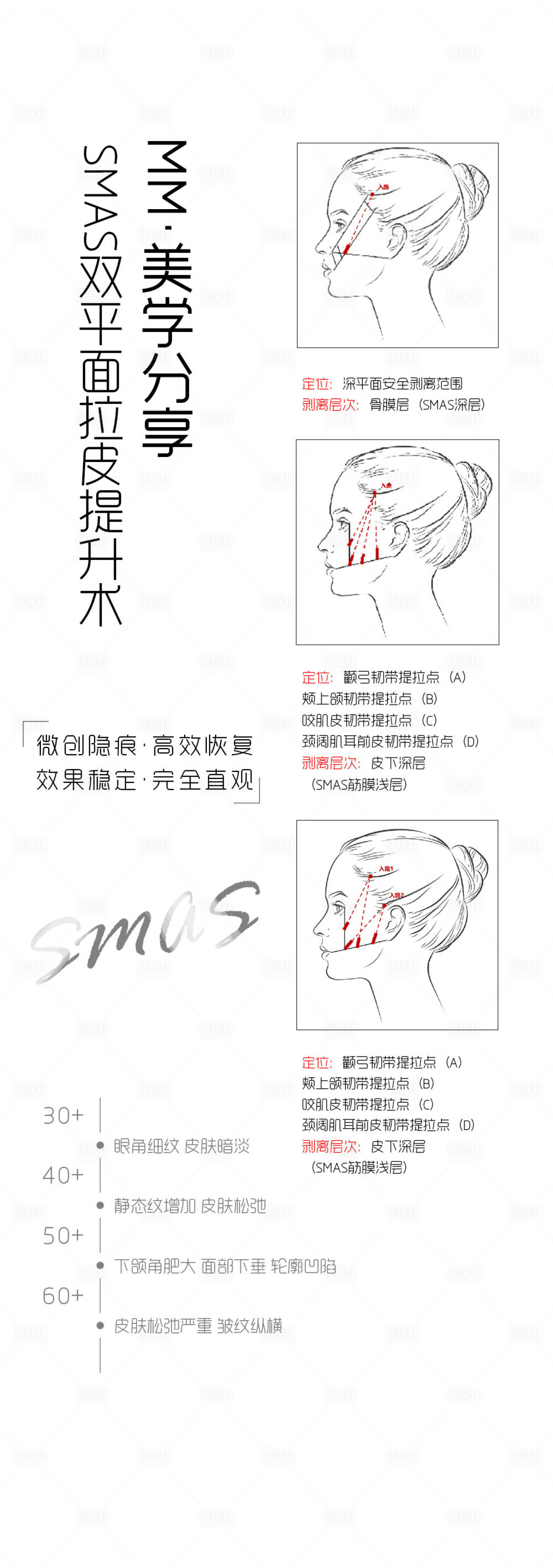 源文件下载【拉皮】编号：46810021459595885