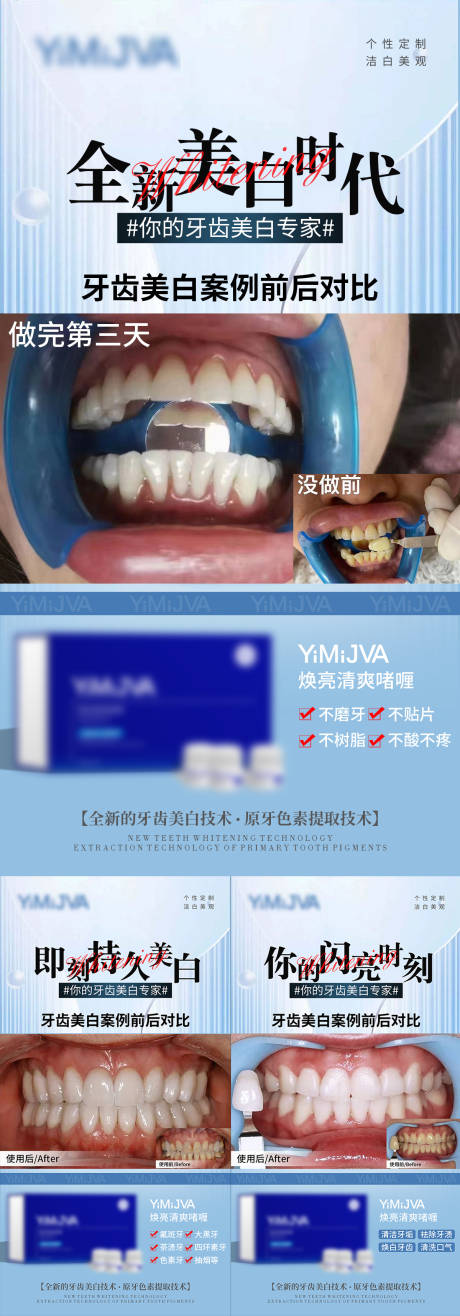 源文件下载【牙齿美白海报】编号：51600021330625868