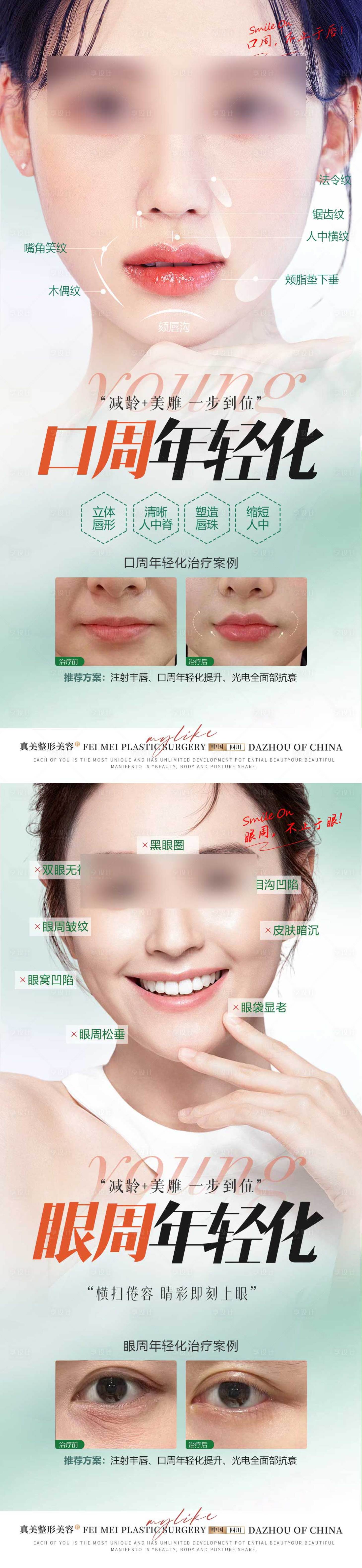 源文件下载【医美口周眼周年轻化案例海报】编号：78620021685375721