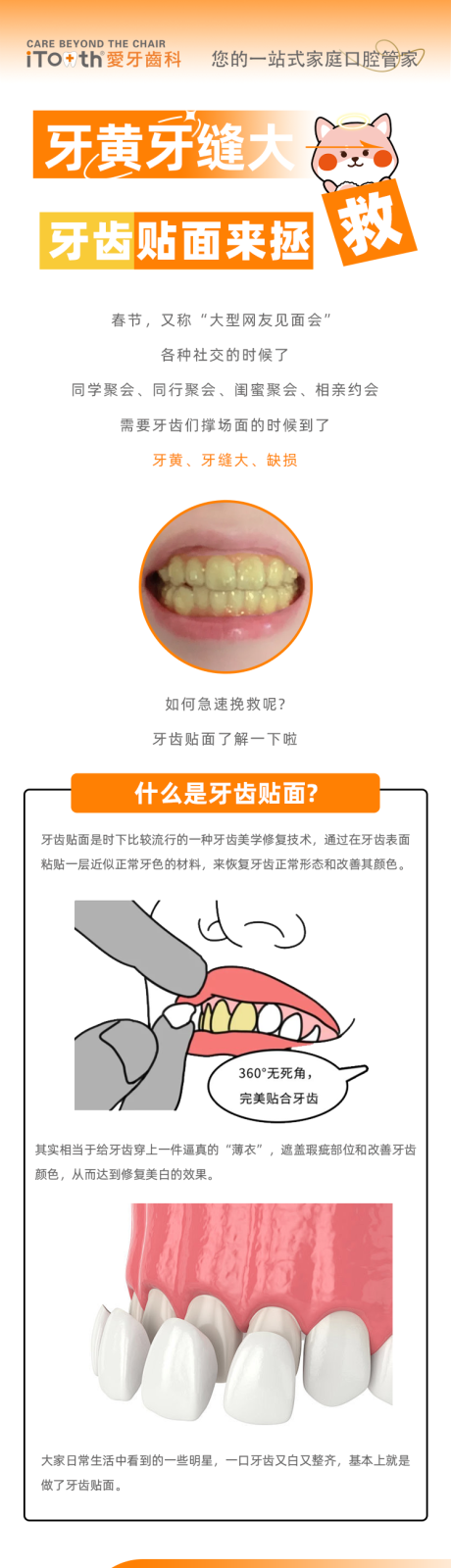 源文件下载【享设计】搜索编号：20050021337343102【口腔科普牙齿贴面修复公众号长图 】
