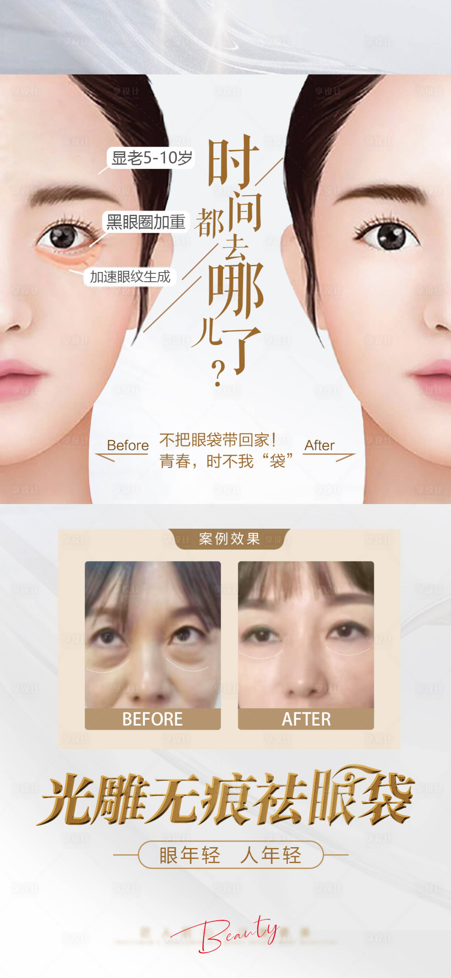 源文件下载【享设计】搜索编号：67680021434374985【医美眼袋对比图抗衰海报】