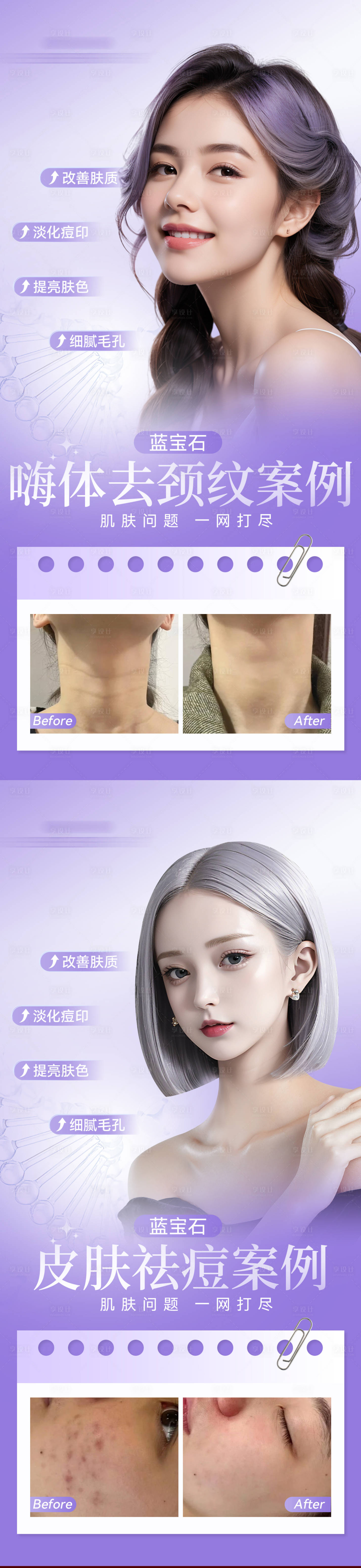 源文件下载【享设计】搜索编号：72760022199889240【医美模特案例海报】