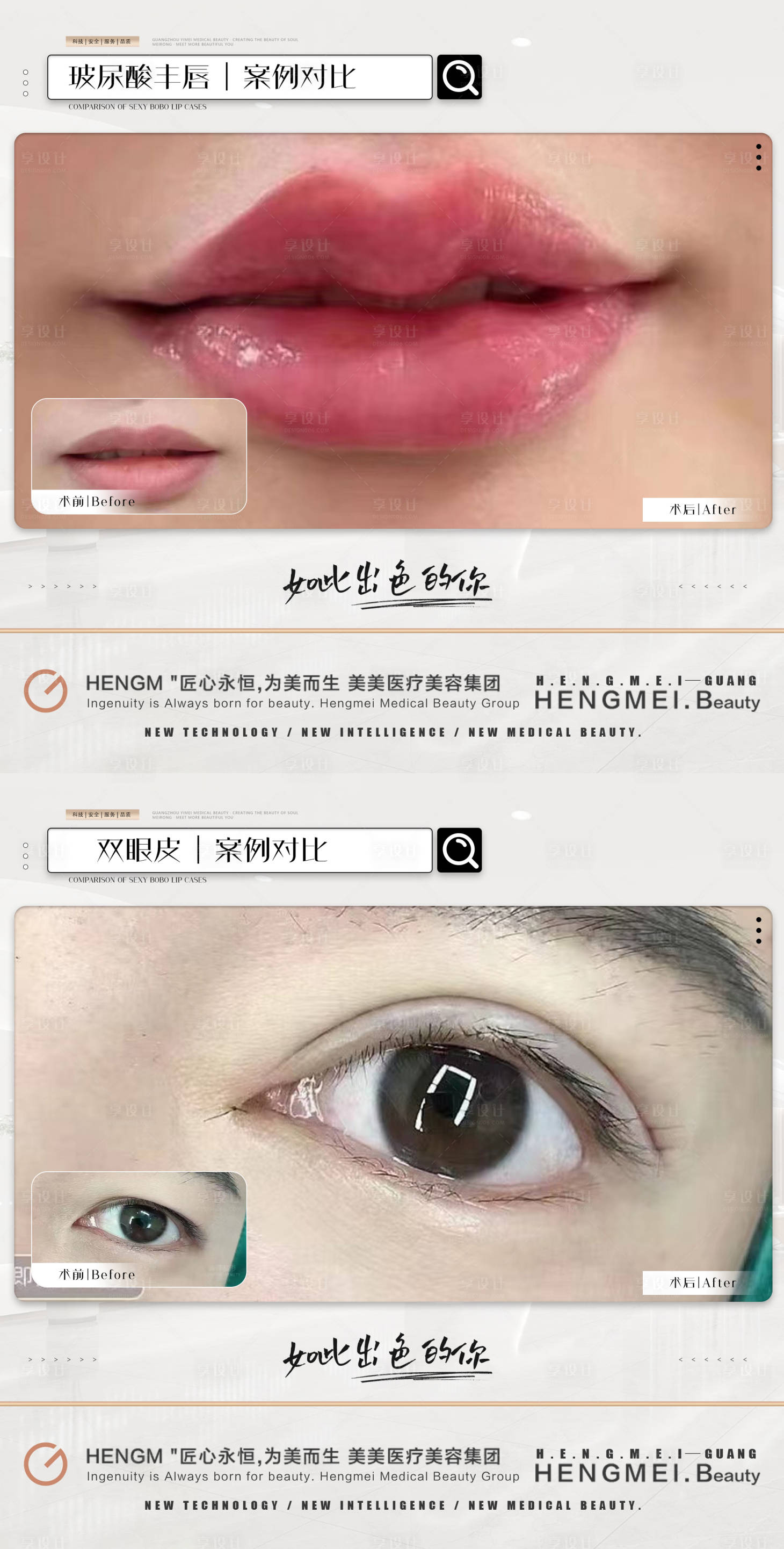 源文件下载【享设计】搜索编号：24770021889823145【医美整形案例简约系列】