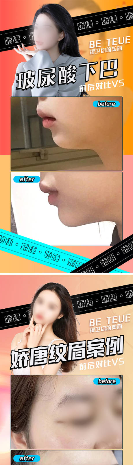 源文件下载【享设计】搜索编号：51330022078435189【医美案例对比】
