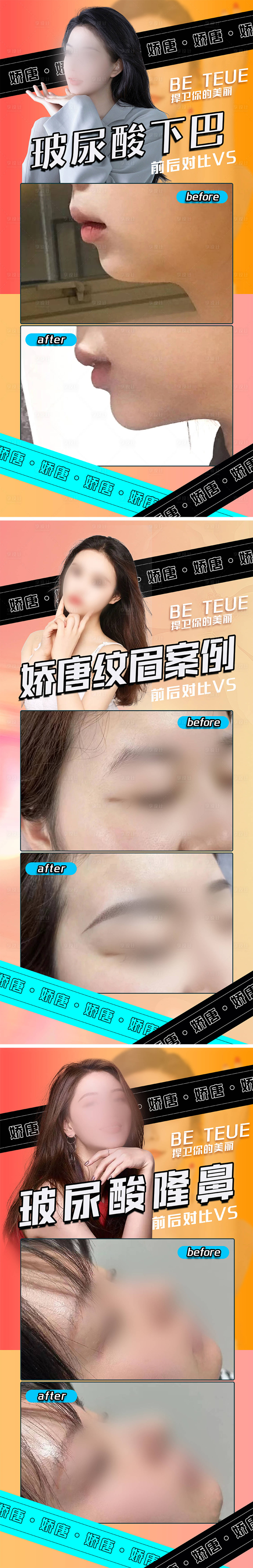 源文件下载【医美案例对比】编号：51330022078435189