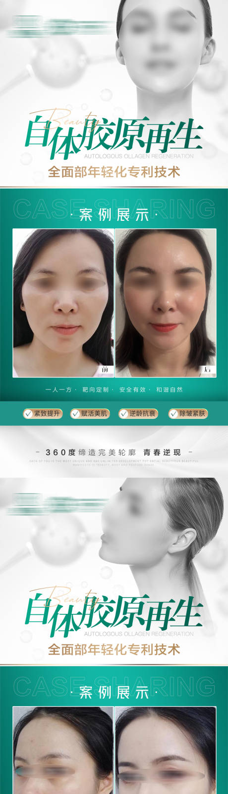 源文件下载【医美海报】编号：45570021887012074