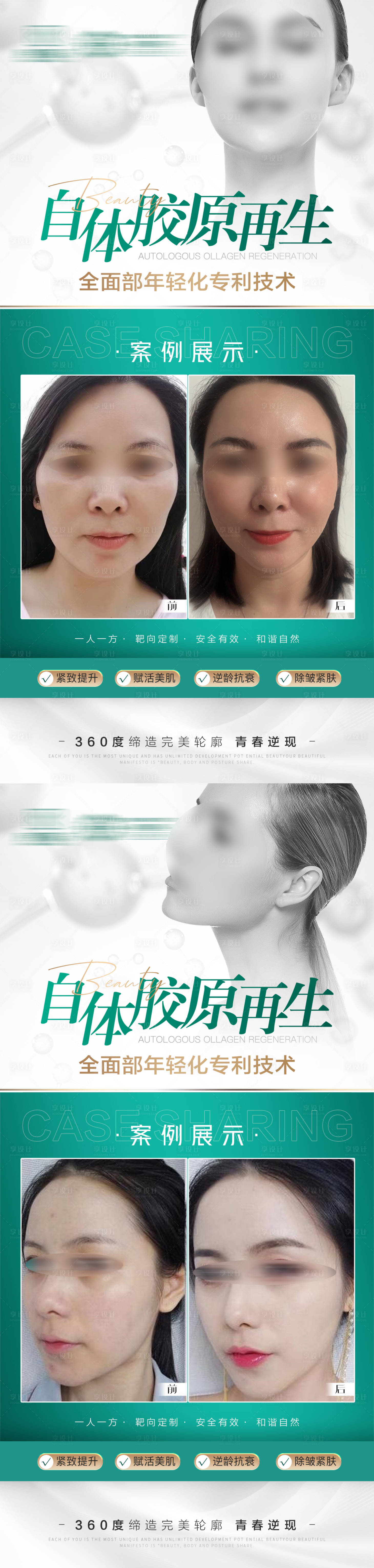 源文件下載【享設(shè)計(jì)】搜索編號：45570021887012074【醫(yī)美海報(bào)】