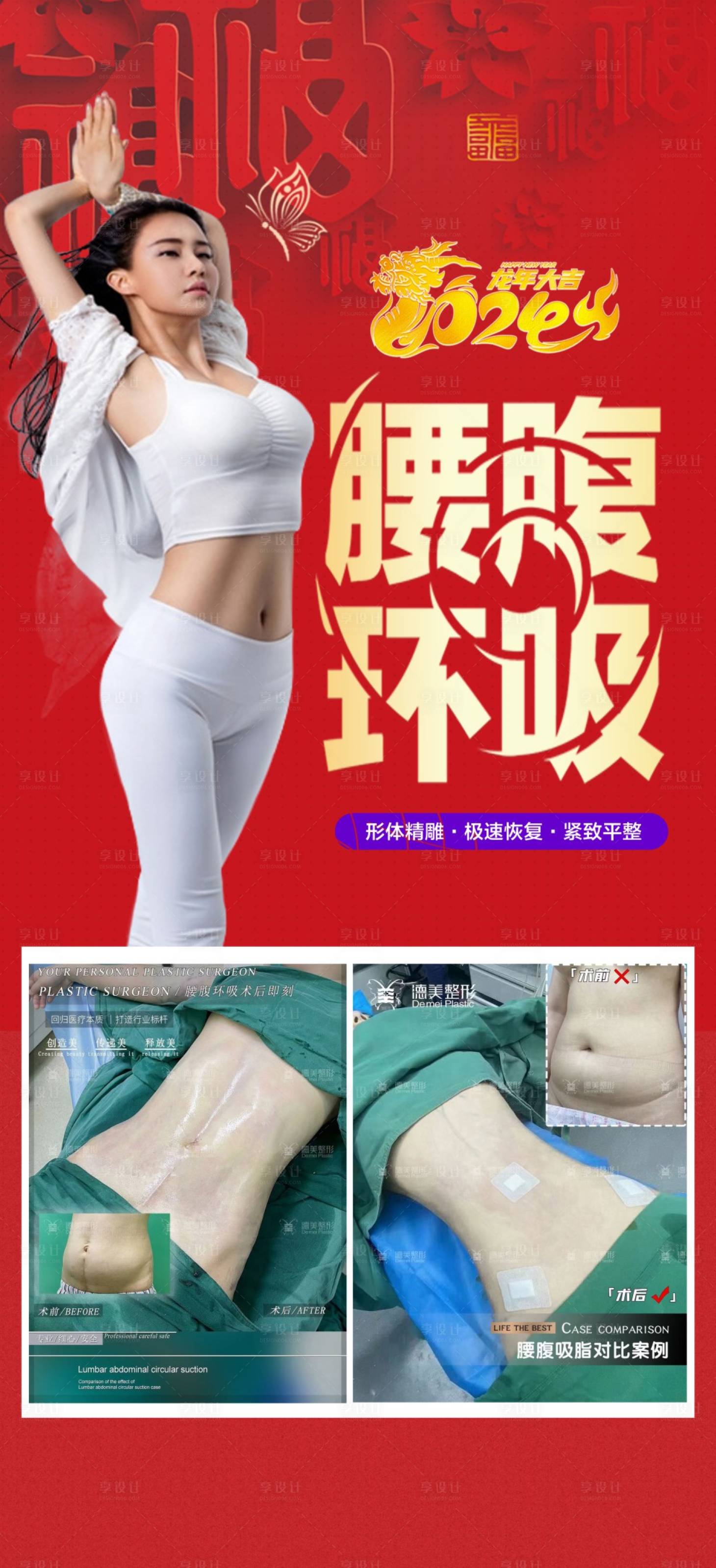 源文件下載【享設(shè)計(jì)】搜索編號(hào)：33520021893364713【腰腹吸脂海報(bào)】