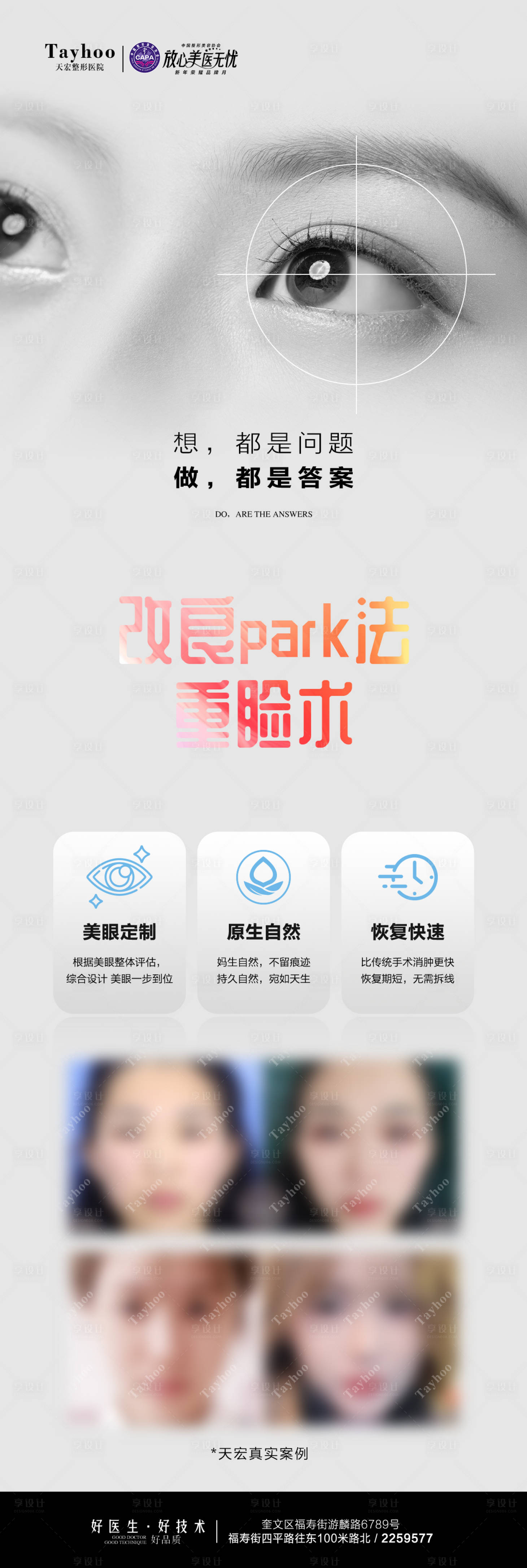 源文件下载【享设计】搜索编号：10010022075064247【眼整形案例海报】