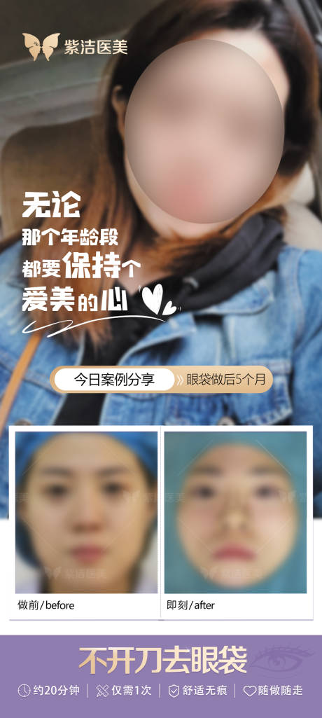 源文件下载【享设计】搜索编号：48590021892725205【案例对比海报】